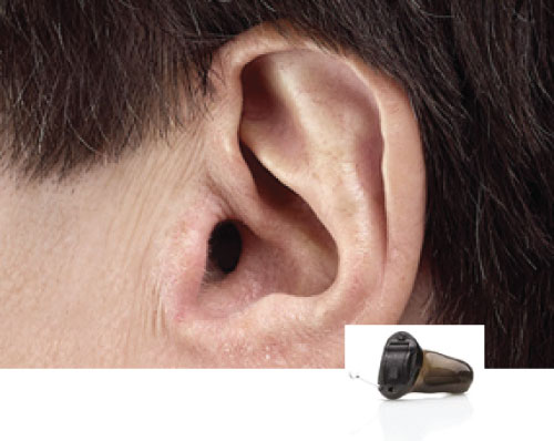 Invisible-In-The-Canal (Iic)